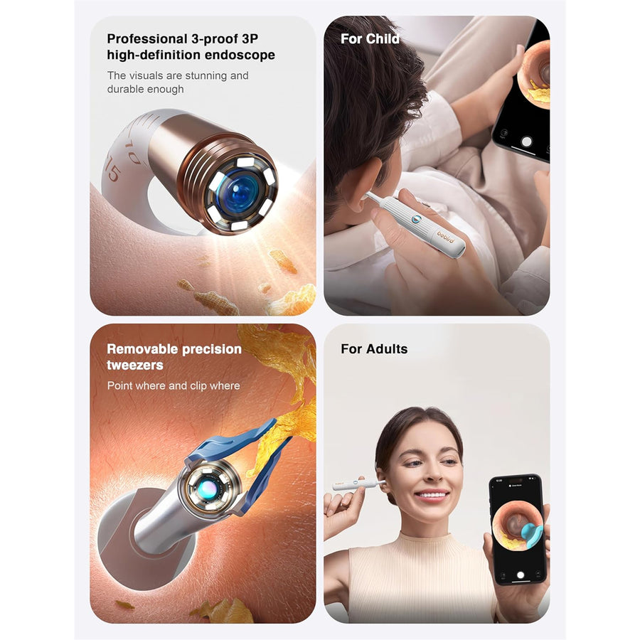Bebird Smart Ear Wax Removal Ear Sight Plus - White