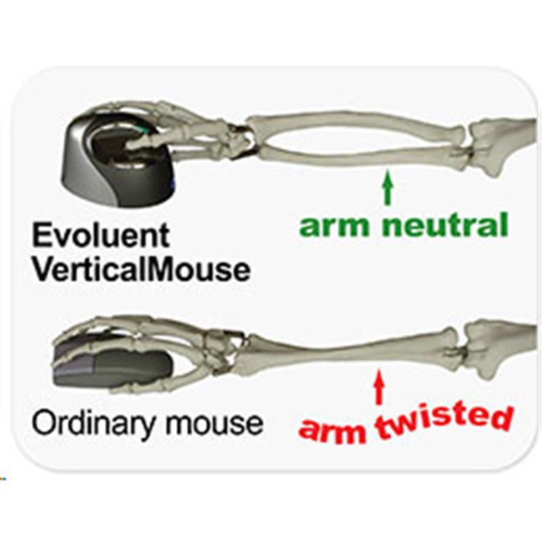 Evoluent VM4RW